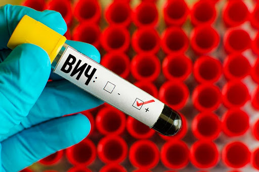 ВИЧ – не приговор: он не вылечивается, но с ним можно жить