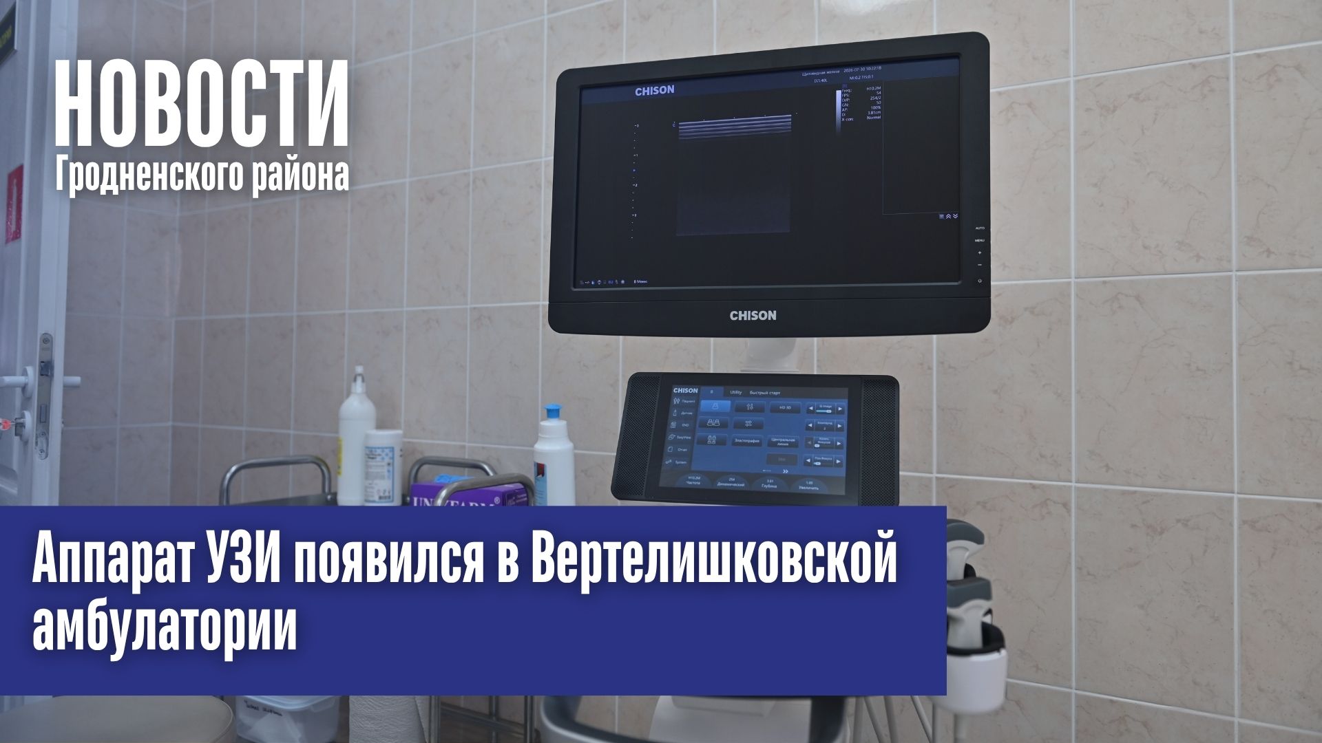 Аппарат УЗИ появился в Вертелишковской амбулатории Аппарат УЗИ появился в Вертелишковской амбулатории