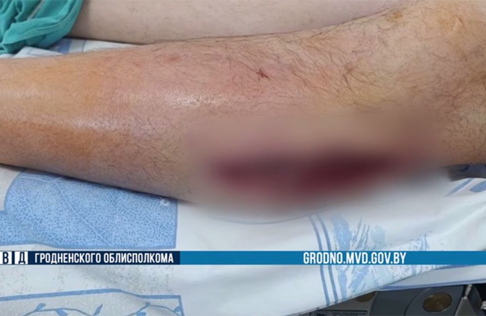 Житель Гродненской области получил огнестрельные ранения в Польше